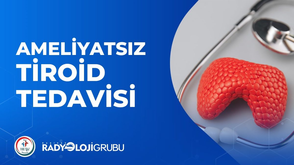 Ameliyatsız Tiroid Nodül Tedavisi 