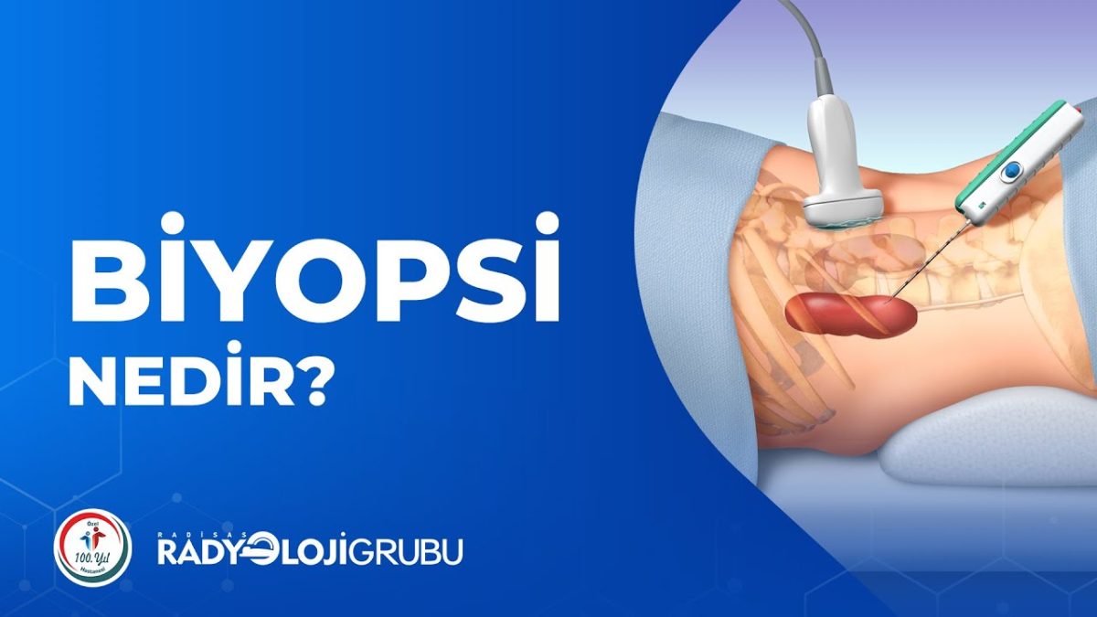 Biyopsi Nedir?