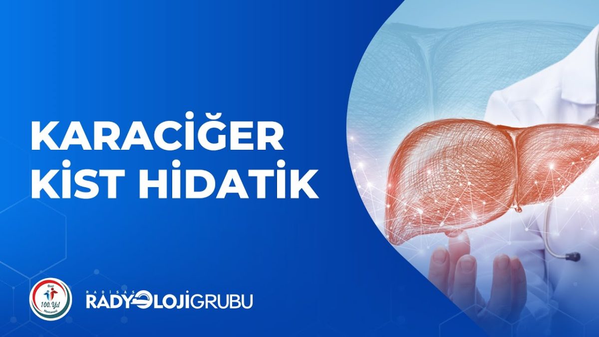 Karaciğer Kist Hidatik
