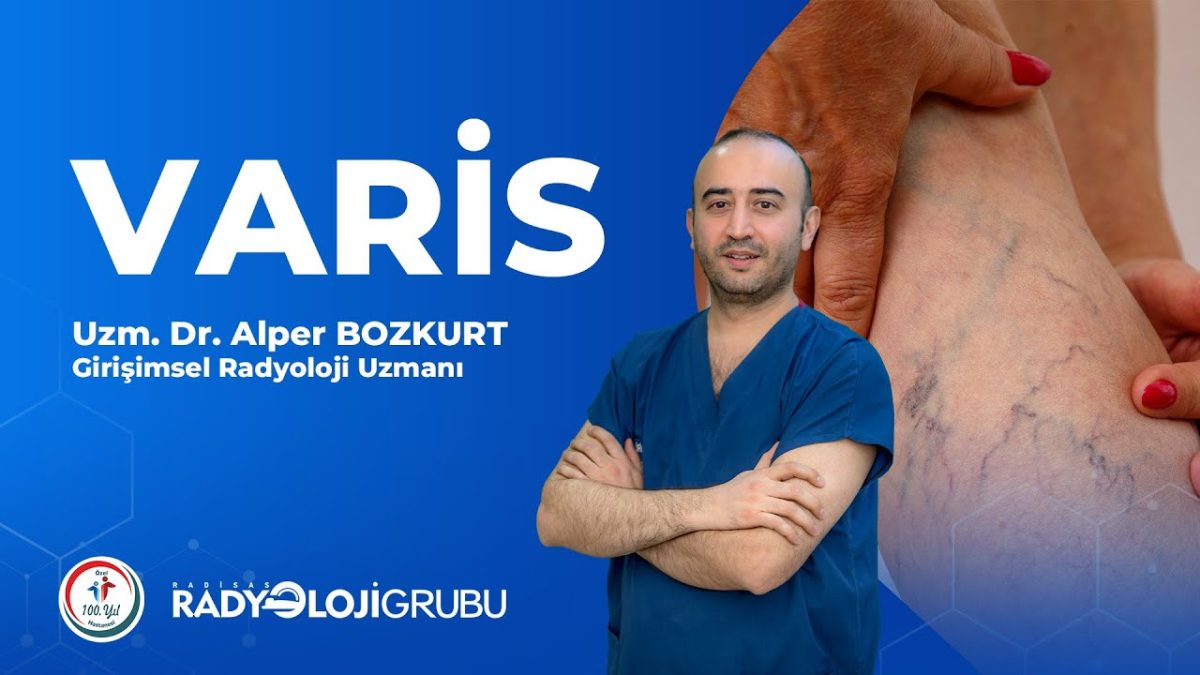 Varis Nedir, Ameliyatsız Varis Tedavisi Nasıl Yapılmaktadır?